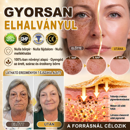 🎁 Gratulálunk! Feloldotta a 𝐇𝐢𝐬𝐤𝐢𝐧® Kurkuma × Kojinsav Éjszakai Maszk exkluzív meglepetés ajánlatát: most 50% kedvezményt kap! Ne maradjon le róla!
