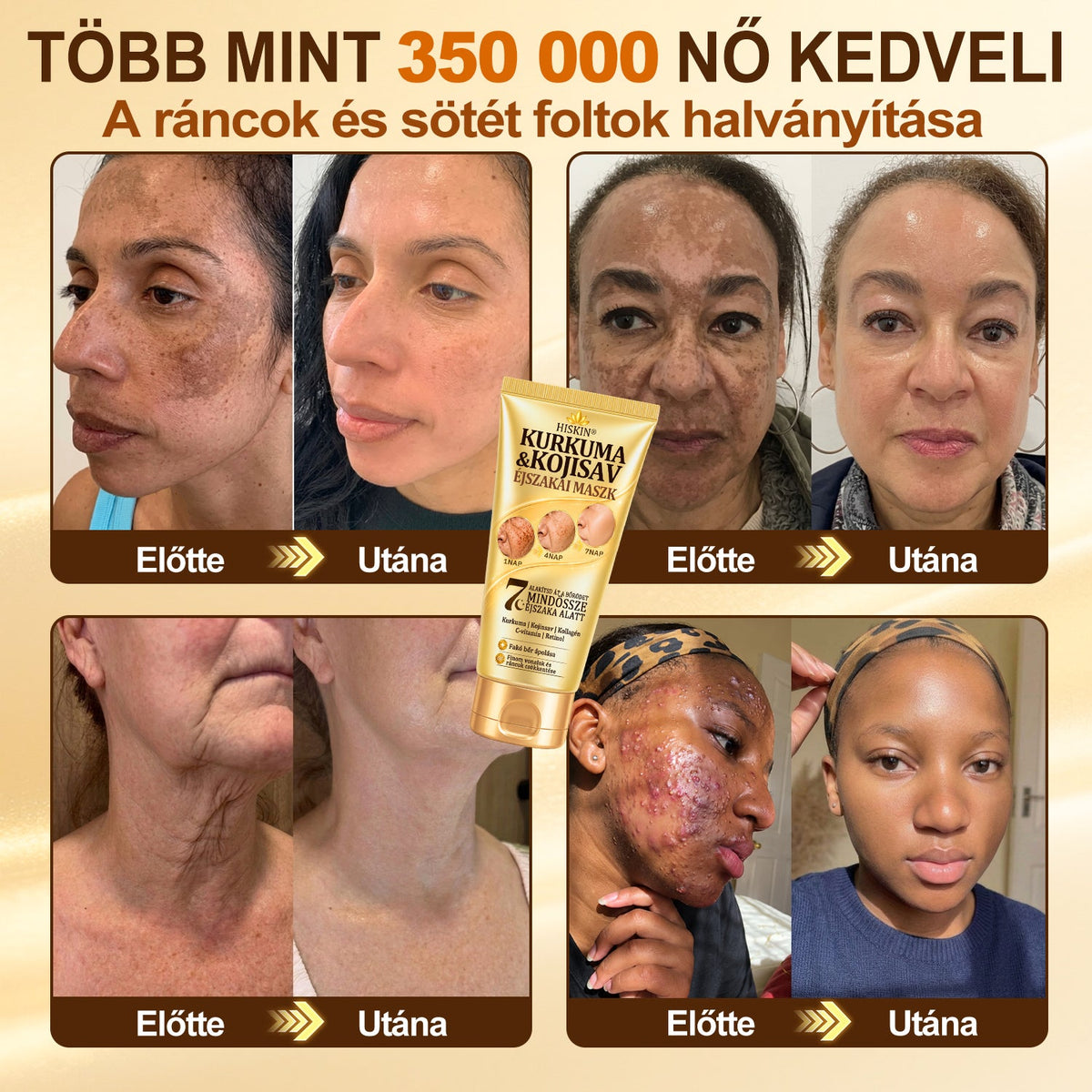 🎁 Gratulálunk! Feloldotta a 𝐇𝐢𝐬𝐤𝐢𝐧® Kurkuma × Kojinsav Éjszakai Maszk exkluzív meglepetés ajánlatát: most 50% kedvezményt kap! Ne maradjon le róla!