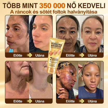 🎁 Gratulálunk! Feloldotta a 𝐇𝐢𝐬𝐤𝐢𝐧® Kurkuma × Kojinsav Éjszakai Maszk exkluzív meglepetés ajánlatát: most 50% kedvezményt kap! Ne maradjon le róla!