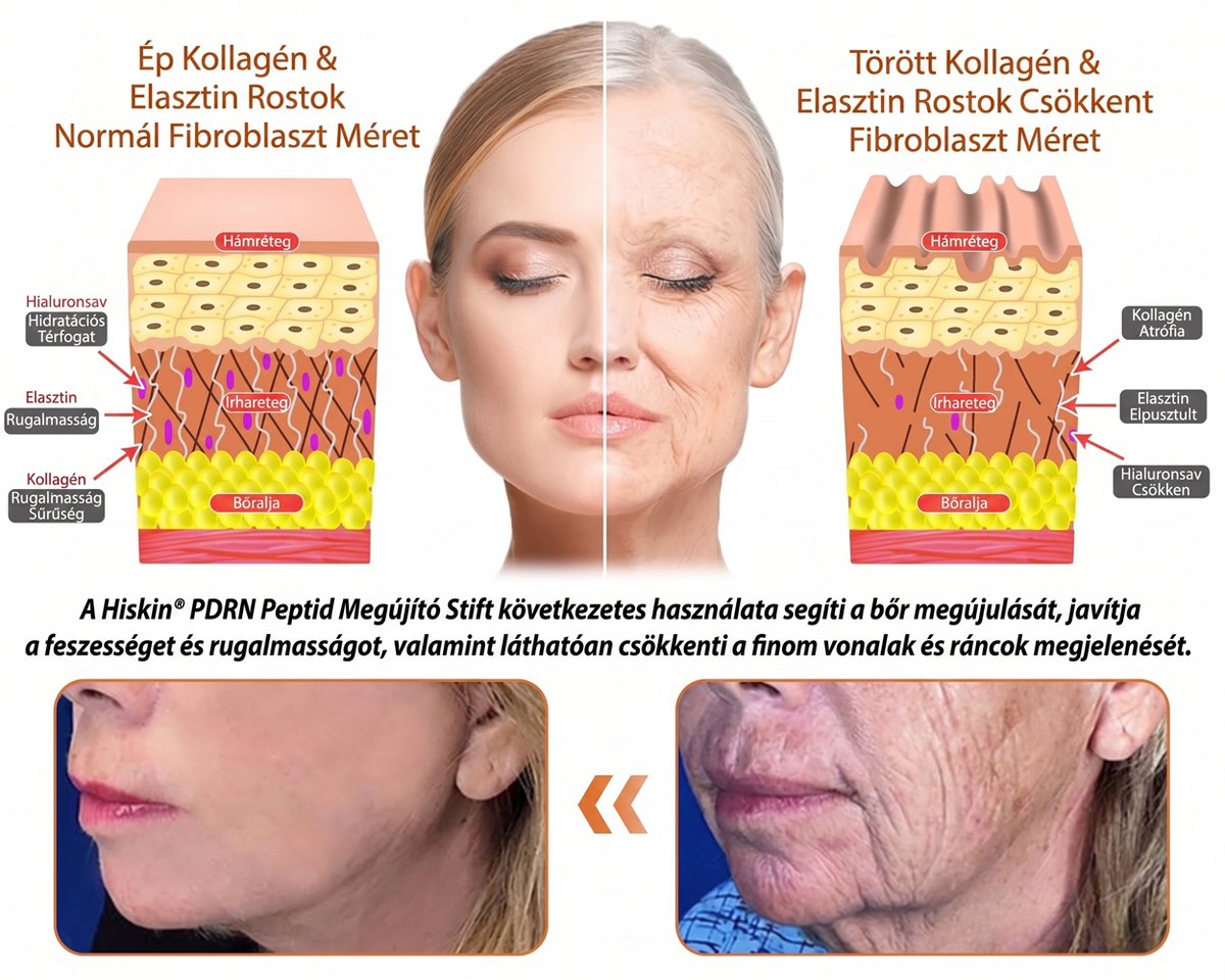 ⏰⏰ Gratulálunk! Exkluzív 𝐇𝐢𝐬𝐤𝐢𝐧® ajánlatot oldott fel! Ma további 30% kedvezményt kap a PDRN bőrmegújító stiftre. Használja ki most, amíg az ajánlat elérhető! ⏰