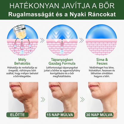 ⏰⏰ Gratulálunk! Exkluzív 𝐇𝐢𝐬𝐤𝐢𝐧® ajánlatot oldott fel! Ma további 30% kedvezményt kap a PDRN bőrmegújító stiftre. Használja ki most, amíg az ajánlat elérhető! ⏰