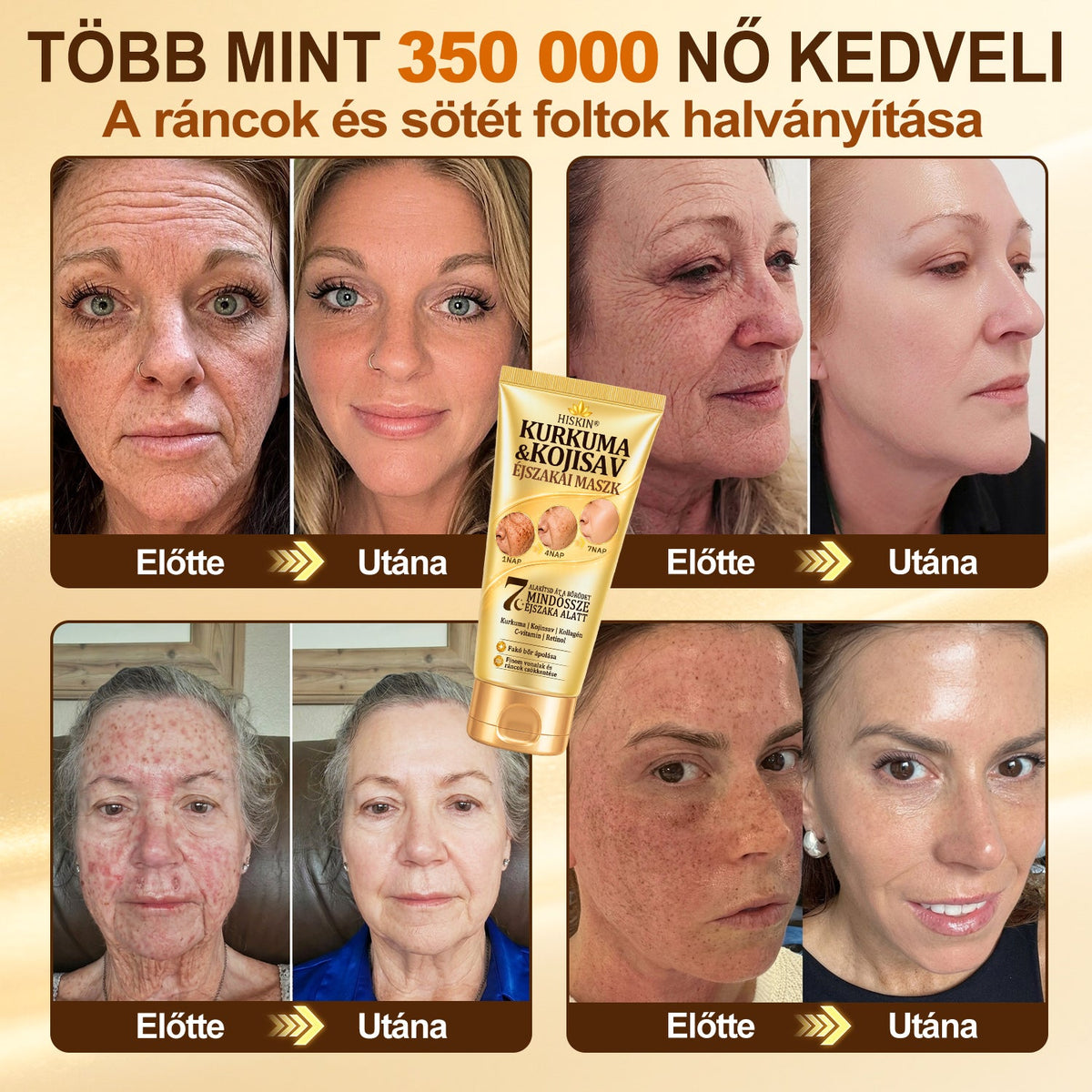 🎁 Gratulálunk! Feloldotta a 𝐇𝐢𝐬𝐤𝐢𝐧® Kurkuma × Kojinsav Éjszakai Maszk exkluzív meglepetés ajánlatát: most 50% kedvezményt kap! Ne maradjon le róla!