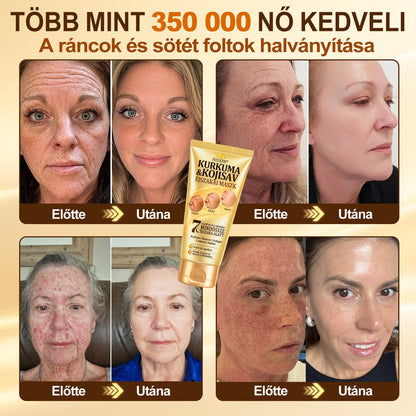 🎁 Gratulálunk! Feloldotta a 𝐇𝐢𝐬𝐤𝐢𝐧® Kurkuma × Kojinsav Éjszakai Maszk exkluzív meglepetés ajánlatát: most 50% kedvezményt kap! Ne maradjon le róla!