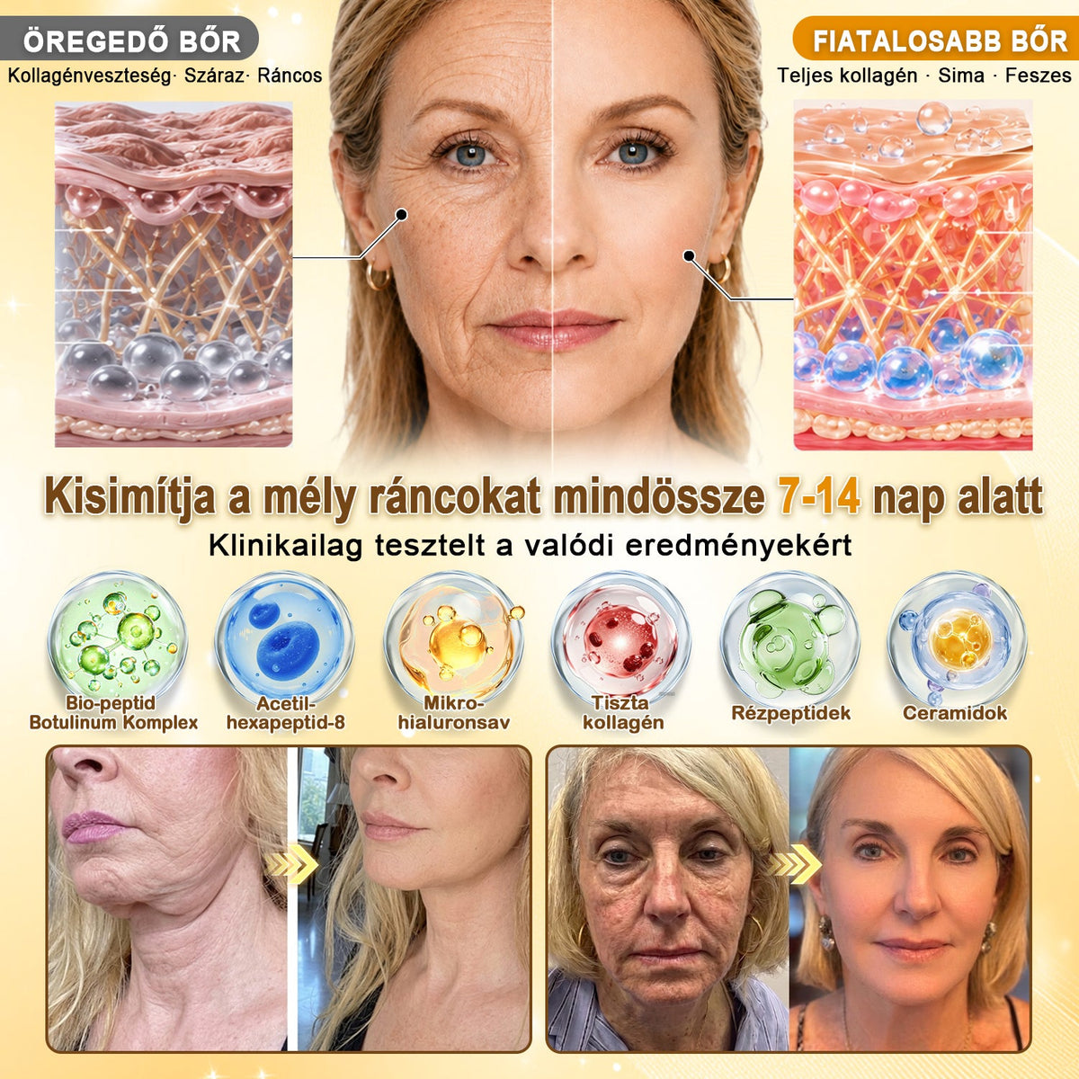🎁 Gratulálunk! Feloldotta a 𝐇𝐢𝐬𝐤𝐢𝐧® Kurkuma × Kojinsav Éjszakai Maszk exkluzív meglepetés ajánlatát: most 50% kedvezményt kap! Ne maradjon le róla!